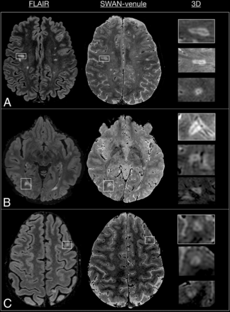 FIG 1.