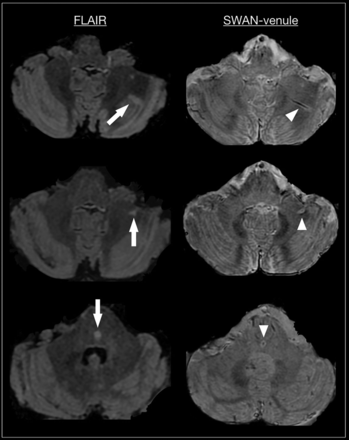 FIG 4.