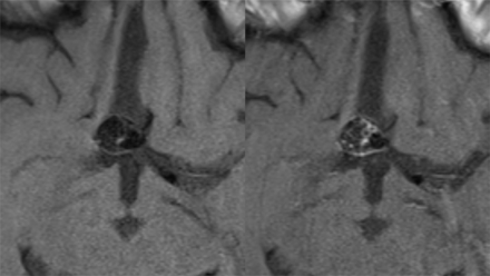 FIG 2.