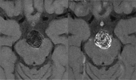 FIG 3.