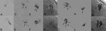FIG 2.