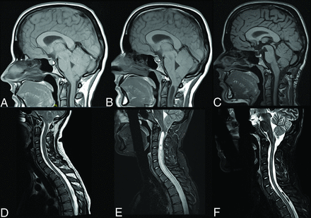 FIG 1.
