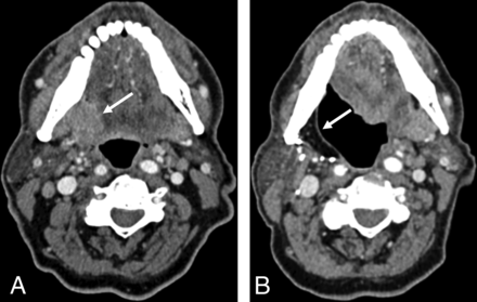 FIG 3.