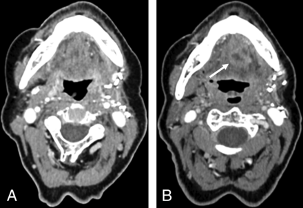 FIG 4.