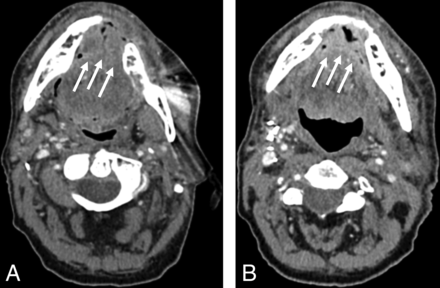 FIG 5.
