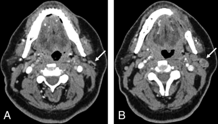 FIG 6.