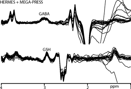 FIG 2.