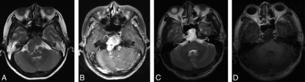 FIG 2.