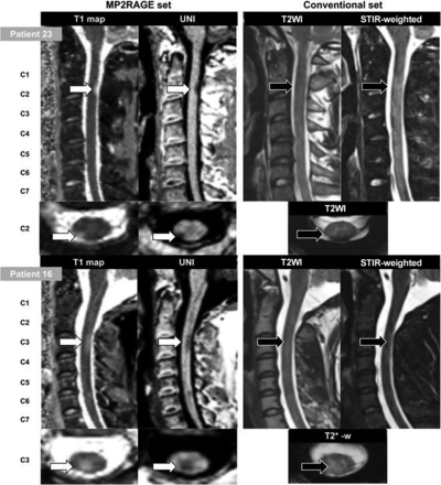 FIG 2.
