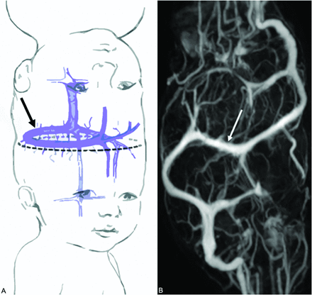 FIG 4.