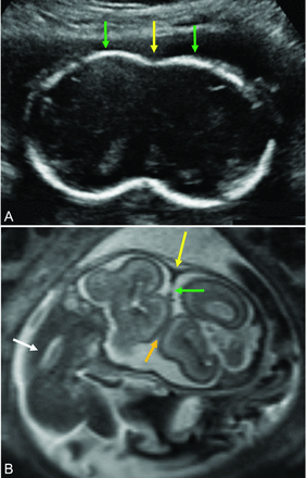 FIG 6.