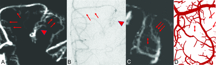 FIG 1.