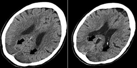 FIG 3.