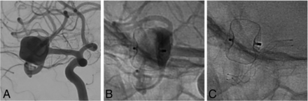 FIG 1.