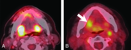 FIG 1.