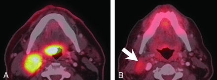 FIG 2.