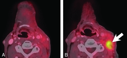 FIG 3.