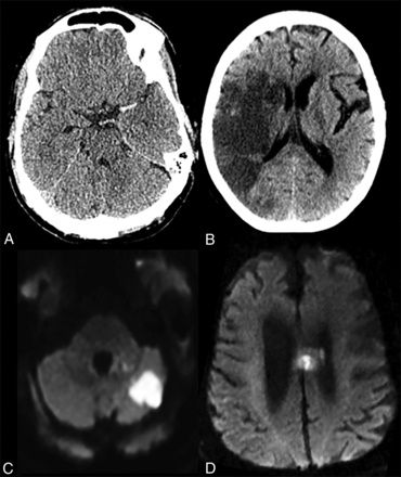 FIG 2.
