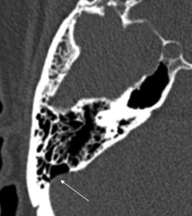 FIG 1.