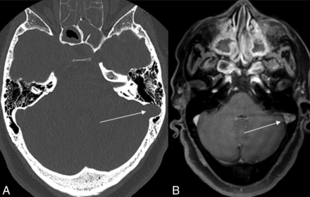 FIG 2.