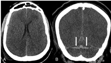 FIG 2.