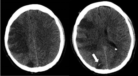 FIG 3.