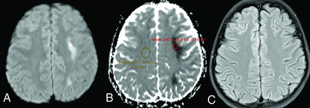 FIG 2.