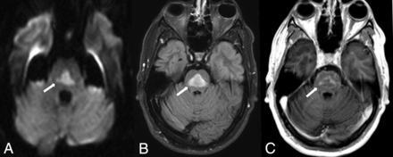 FIG 14.