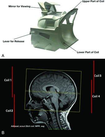 FIG 1.