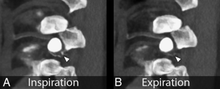 FIG 3.