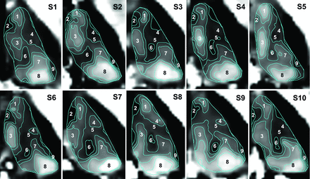 FIG 2.