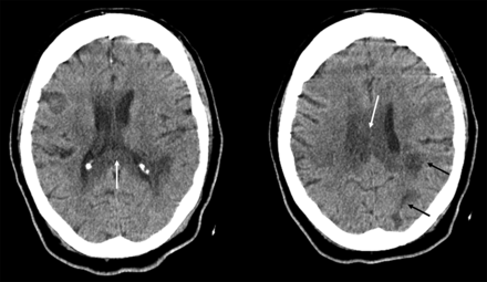 FIG 1.