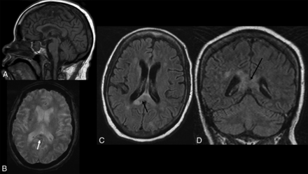 FIG 4.