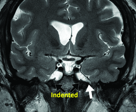 FIG 2.