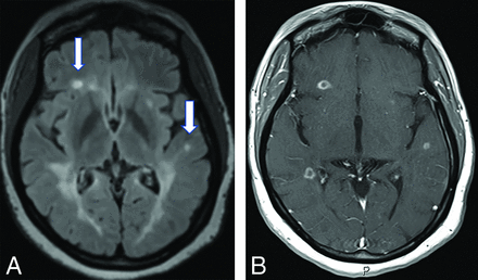 FIG 2.