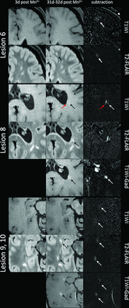FIG 3.