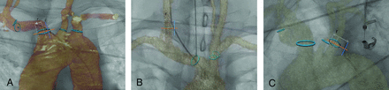 FIG 3.
