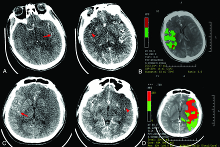 FIG 1.