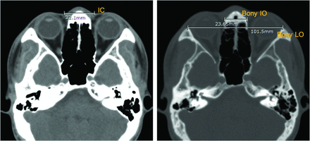 FIG 2.