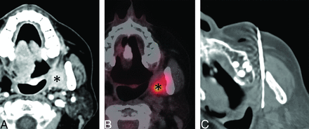 FIG 3.