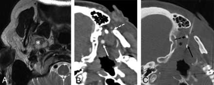 FIG 4.