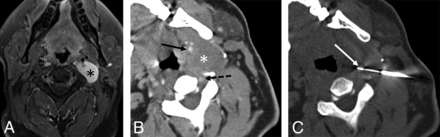 FIG 5.