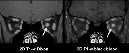 FIG 1.