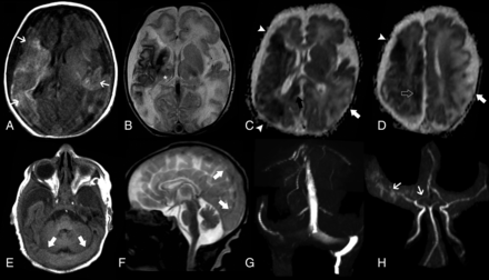 FIG 1.