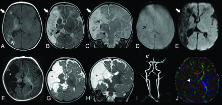 FIG 3.
