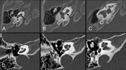 FIG 1.