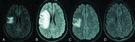FIG 2.