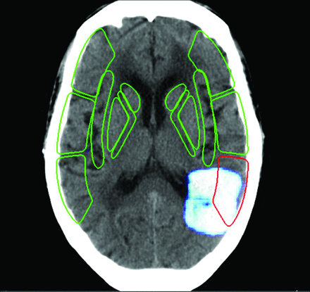 FIG 3.