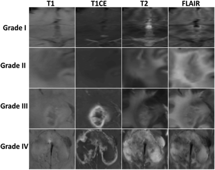 FIG 4.