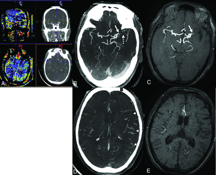 FIG 1.